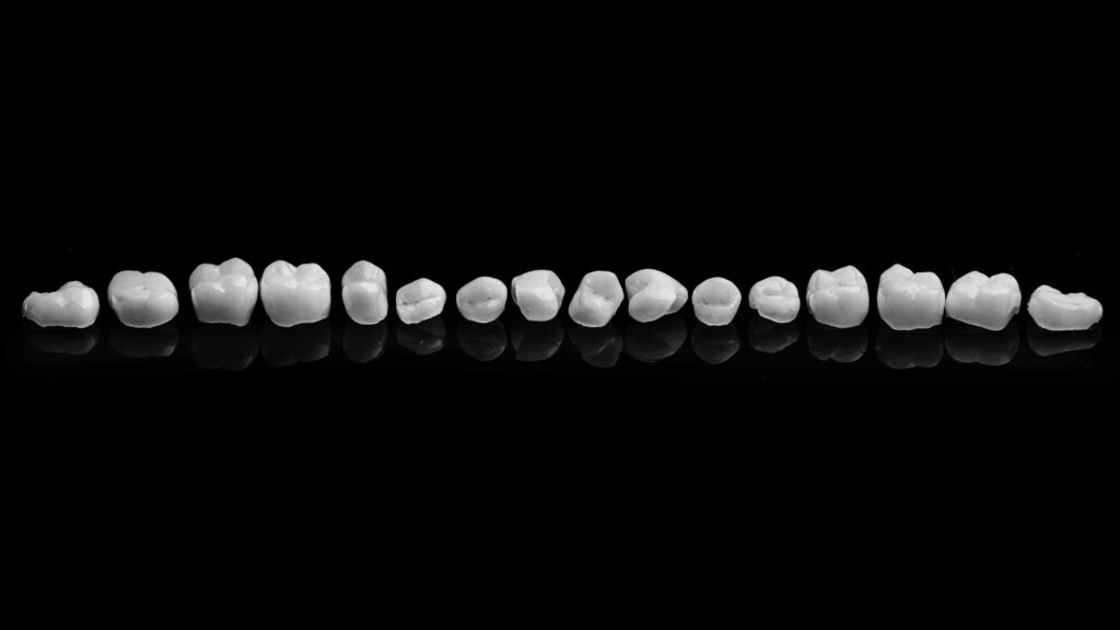 黒い背景の前にセラミックの歯が並べられている