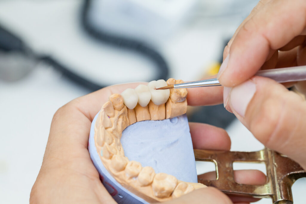 セラミック歯の調整を行う歯科技工士