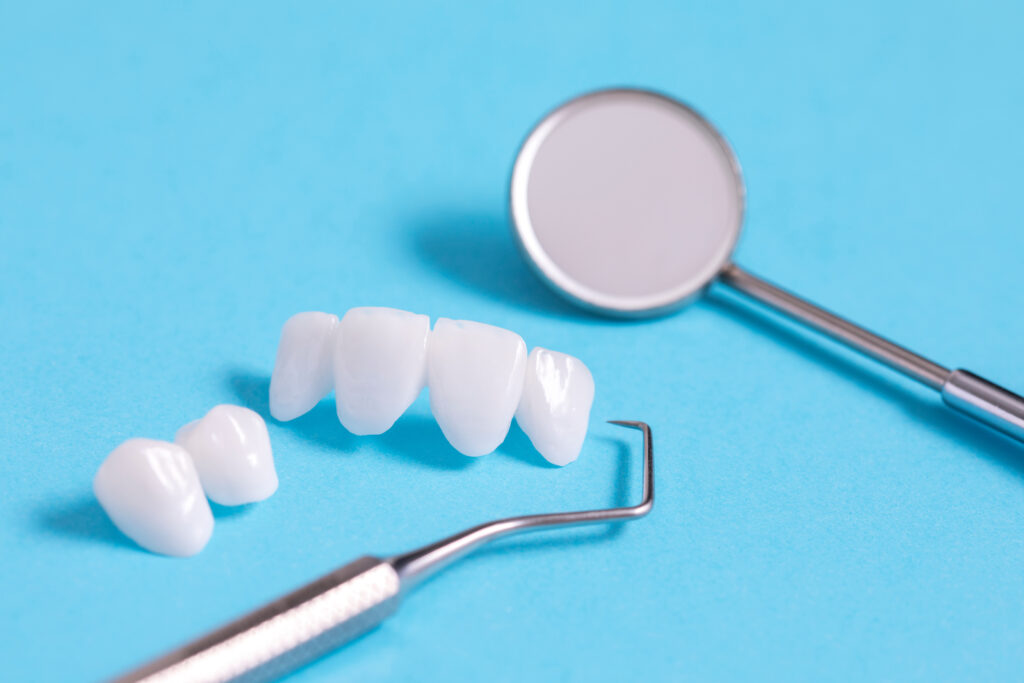 歯科治療用の器具とセラミックの歯の模型
