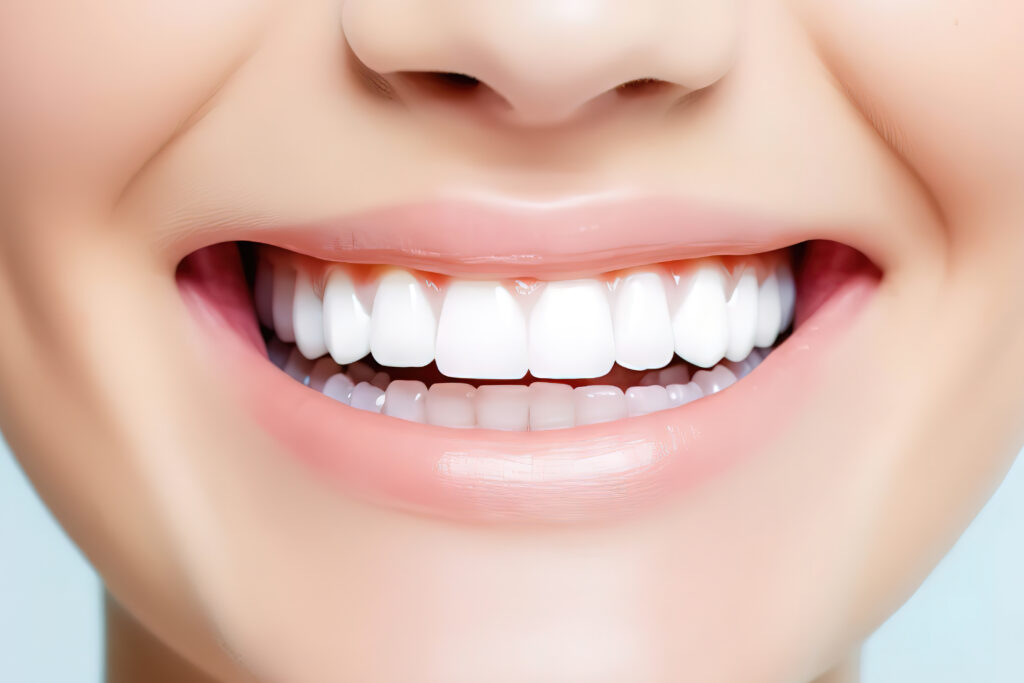 セラミック治療で綺麗になった歯を見せて笑う女性